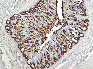 Cytokeratin 18