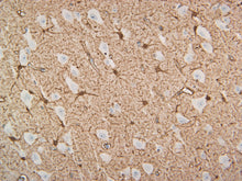 Load image into Gallery viewer, Feline cortex stained with S100B
