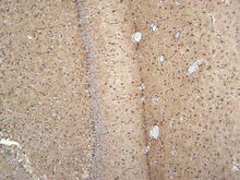 Load image into Gallery viewer, Feline brain stained with GFAP. 10X
