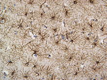 Load image into Gallery viewer, Feline brain stained with GFAP. 40X
