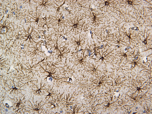 Feline brain stained with GFAP. 40X