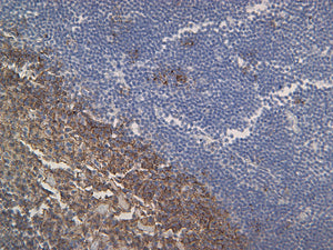 Feline lymph node stained with CD20