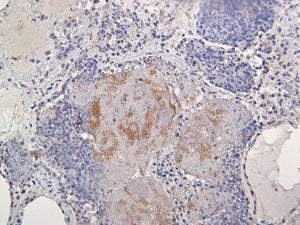 Pan Bacteria