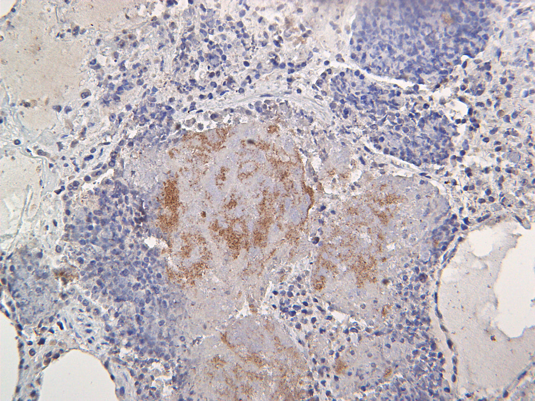 Pan Bacteria