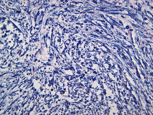 Vimentin