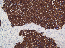 Load image into Gallery viewer, Cytokeratin 10
