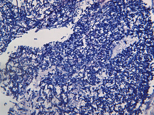 Pan Fungal
