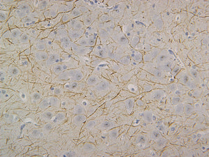 Neurofilament (NF-H)