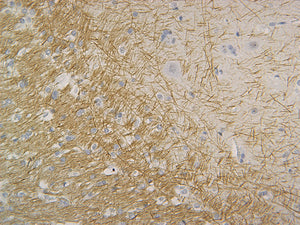 Neurofilament (NF-H)
