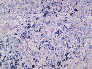Microphthalmia-Associated Transcription Factor (MITF)
