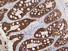 Load image into Gallery viewer, Cytokeratin LMW
