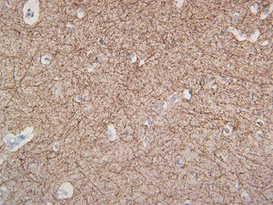Neurofilament (NF-H)
