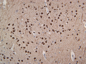 Neurofilament (NF-L)