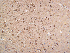 Neurofilament (NF-L)