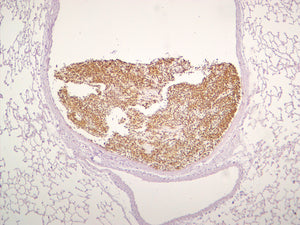 Pan Fungal
