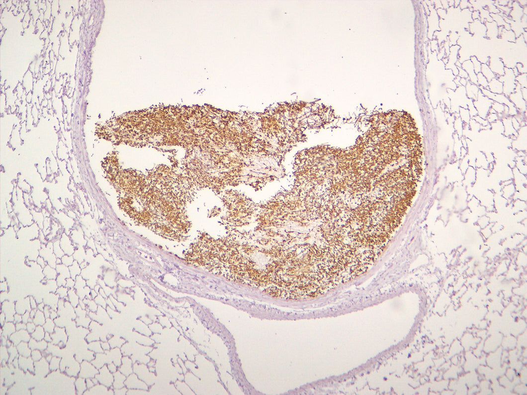 Pan Fungal
