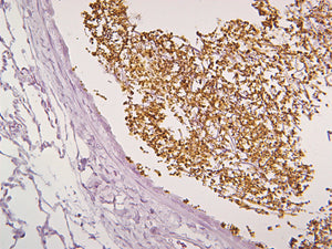Pan Fungal