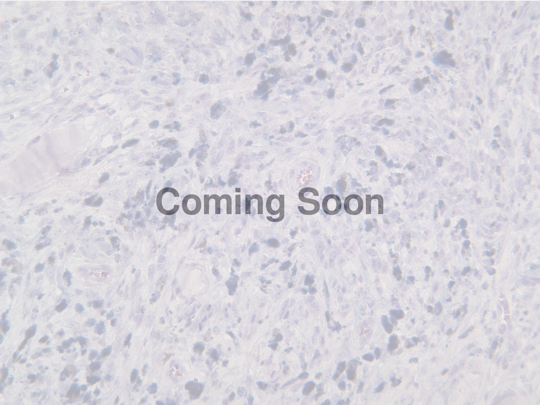 Microphthalmia-Associated Transcription Factor (MITF)