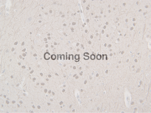 Neurofilament (NF-L)