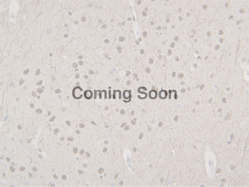 Neurofilament (NF-L)