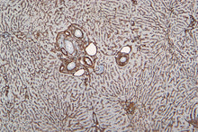 Load image into Gallery viewer, Smooth Muscle Actin [VMAB005] on Dog Melanoma, 10X
