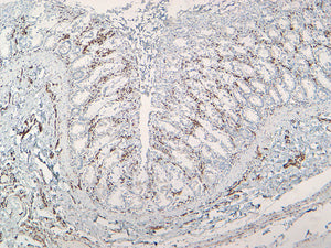 Vimentin