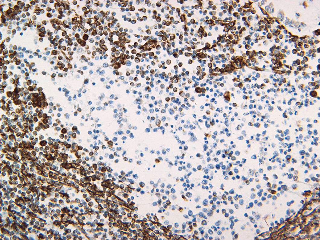 Vimentin